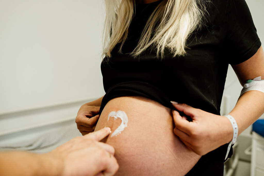 poród w szpitalu, fotografia porodowa, Natu Naturalnie fotograf Lublin Łęczna Świdnik, lubelskie